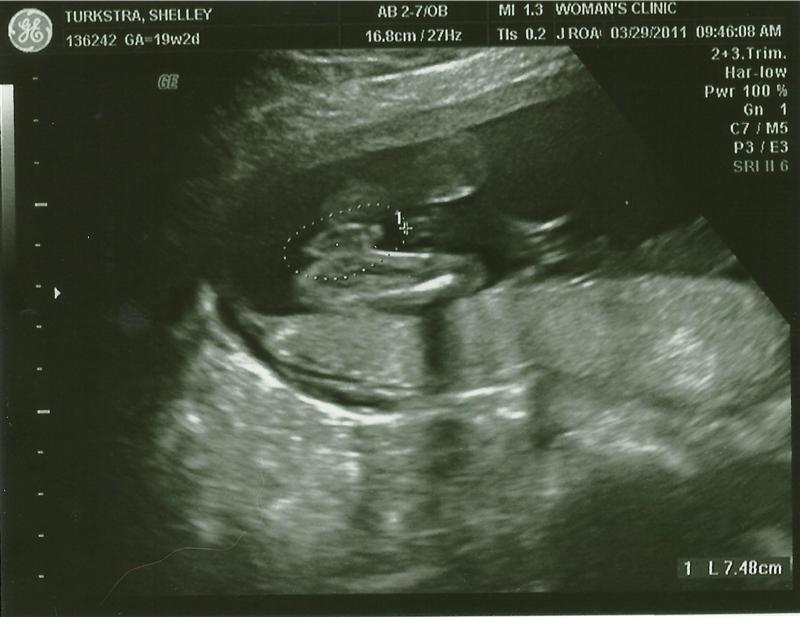 album/03292011/images/babyturk01.jpg