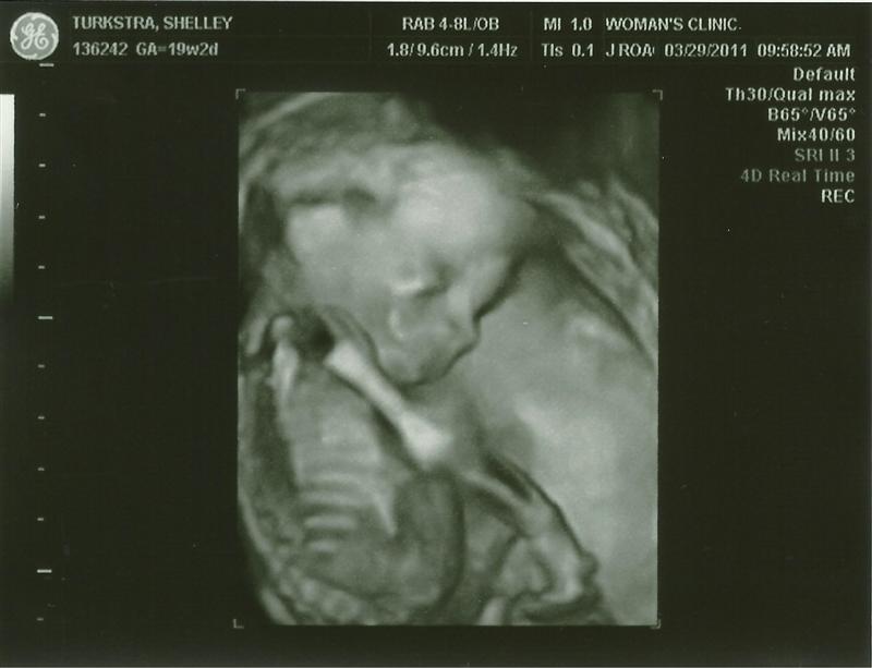 album/03292011/images/babyturk16.jpg