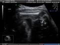 album/05262011/BABY052611_3.JPG