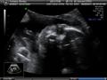 album/05262011/BABY052611_8.JPG